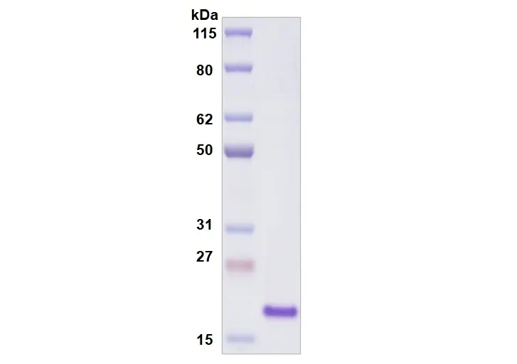 Recombinant Human Siglec-9, His Tag -100 ug